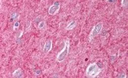 Anti-ICAM5 precursor antibody, C-term used in IHC (Paraffin sections) (IHC-P). GTX89232