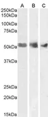 Anti-Wilms Tumor 1 antibody, N-term used in Western Blot (WB). GTX89257