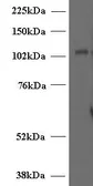 Anti-Munc 13-4 antibody, Internal used in Western Blot (WB). GTX89269