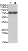 Anti-HSC70 antibody, Internal used in Western Blot (WB). GTX89273