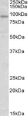 Anti-STAT3 antibody, Internal used in Western Blot (WB). GTX89276