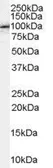 Anti-FE65 antibody, C-term used in Western Blot (WB). GTX89278