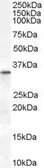 Anti-VDAC2 antibody, Internal used in Western Blot (WB). GTX89279