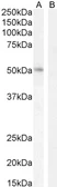 Anti-LEF1 antibody, Internal used in Western Blot (WB). GTX89284