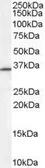 Anti-RNF115 antibody, Internal used in Western Blot (WB). GTX89285