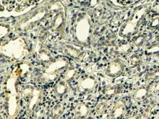 Anti-Tensin 1 antibody, C-term used in IHC (Paraffin sections) (IHC-P). GTX89292