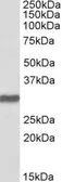 Anti-Oct4 antibody, C-term used in Western Blot (WB). GTX89295