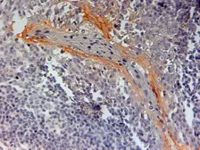 Anti-NLRP3 antibody, Internal used in IHC (Paraffin sections) (IHC-P). GTX89303
