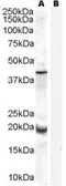 Anti-GPX7 antibody, Internal used in Western Blot (WB). GTX89305