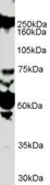 Anti-ROBO1 antibody, Internal used in Western Blot (WB). GTX89308