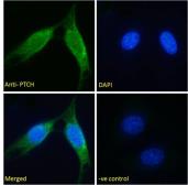 Anti-PTCH1 antibody, Internal used in Immunocytochemistry/ Immunofluorescence (ICC/IF). GTX89309