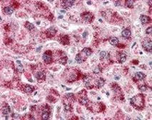 Anti-Catalase antibody, Internal used in IHC (Paraffin sections) (IHC-P). GTX89332
