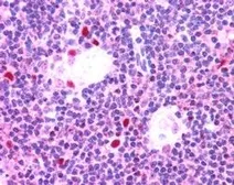 Anti-AIRE (isoform 1) antibody, Internal used in IHC (Paraffin sections) (IHC-P). GTX89336