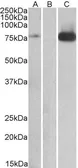 Anti-TAK1 antibody, Internal used in Western Blot (WB). GTX89337