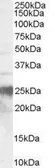 Anti-Prion Protein (PrP) (143-153) antibody, Internal used in Western Blot (WB). GTX89339