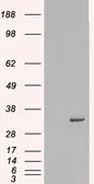 Anti-Syntaxin 6 antibody, Internal used in Western Blot (WB). GTX89342
