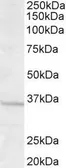 Anti-GNB3 antibody, Internal used in Western Blot (WB). GTX89343