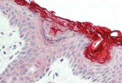 Anti-PERP antibody, C-term used in IHC (Paraffin sections) (IHC-P). GTX89344
