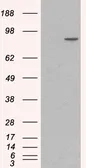 Anti-alpha 1 Catenin antibody, Internal used in Western Blot (WB). GTX89347