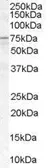 Anti-ACSL5 antibody, C-term used in Western Blot (WB). GTX89348