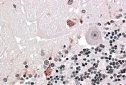 Anti-PRODH antibody, Internal used in IHC (Paraffin sections) (IHC-P). GTX89352