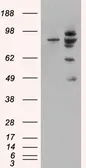 Anti-MDM2 antibody, Internal used in Western Blot (WB). GTX89355