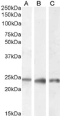 Anti-PGRMC1 antibody, C-term used in Western Blot (WB). GTX89362