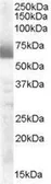 Anti-CYP17A1 antibody, Internal used in Western Blot (WB). GTX89365