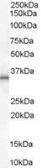 Anti-UCP1 antibody, C-term used in Western Blot (WB). GTX89371