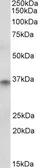 Anti-CDX2 antibody, Internal used in Western Blot (WB). GTX89372