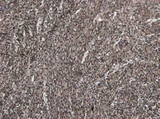 Anti-beta 1 Adrenergic Receptor antibody, Internal used in IHC (Paraffin sections) (IHC-P). GTX89376