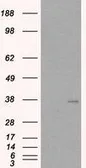 Anti-TIM-3 antibody, Internal used in Western Blot (WB). GTX89379