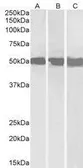 Anti-DDX6 antibody, C-term used in Western Blot (WB). GTX89391