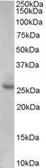 Anti-p27 Kip1 antibody, Internal used in Western Blot (WB). GTX89392