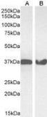 Anti-GAPDH antibody, Internal used in Western Blot (WB). GTX89409