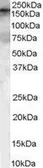 Anti-ARHGEF5 antibody, Internal used in Western Blot (WB). GTX89412