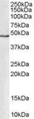 Anti-GATA1 antibody, Internal used in Western Blot (WB). GTX89442