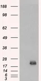 Anti-BAALC antibody, Internal used in Western Blot (WB). GTX89453