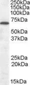 Anti-Cannabinoid receptor 1 antibody, Internal used in Western Blot (WB). GTX89458