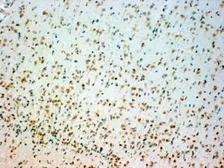 Anti-TPH2 antibody, Internal used in IHC (Paraffin sections) (IHC-P). GTX89459