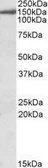 Anti-EPB41L3 antibody, C-term used in Western Blot (WB). GTX89463