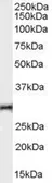 Anti-TNFRSF14 antibody, Internal used in Western Blot (WB). GTX89465