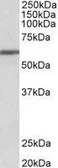 Anti-ZNF703 antibody, Internal used in Western Blot (WB). GTX89468
