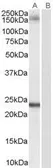 Anti-GOLGA3 antibody, C-term used in Western Blot (WB). GTX89474