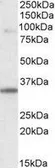 Anti-LDB3 antibody, Internal used in Western Blot (WB). GTX89478