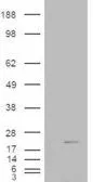 Anti-Cofilin 2 antibody, C-term used in Western Blot (WB). GTX89482