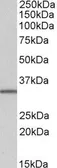 Anti-NHERF2 antibody, Internal used in Western Blot (WB). GTX89484