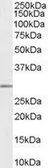 Anti-MMP7 antibody, C-term used in Western Blot (WB). GTX89487