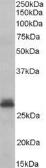 Anti-Tafazzin / TAZ antibody, C-term used in Western Blot (WB). GTX89488