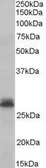 Anti-Tafazzin / TAZ antibody, C-term used in Western Blot (WB). GTX89488
